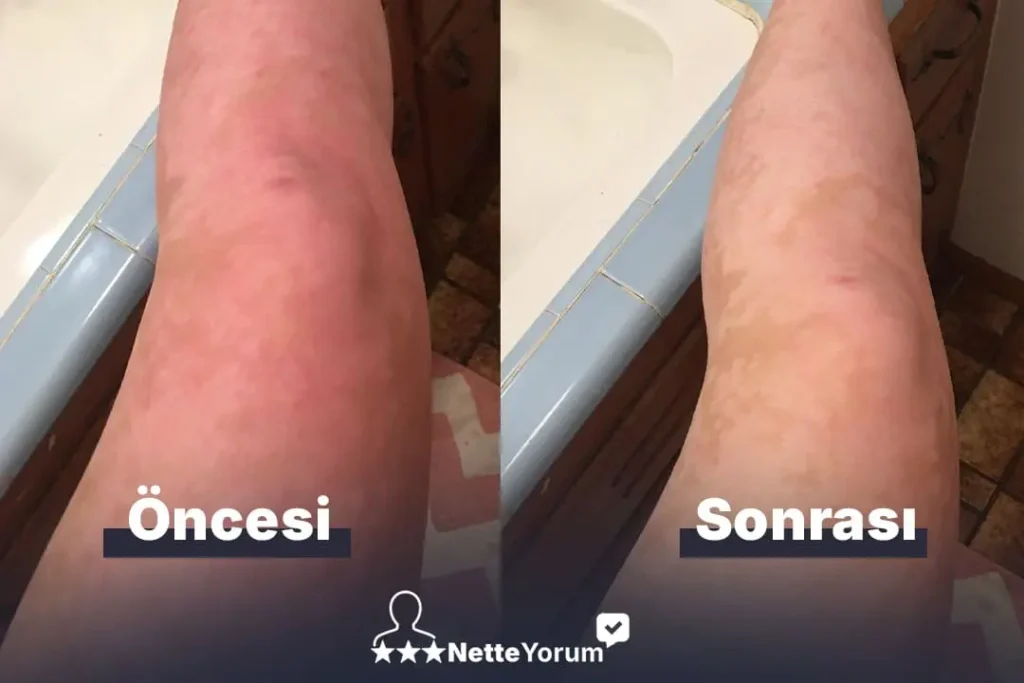 Görsel - Kullanıcı Yorumları