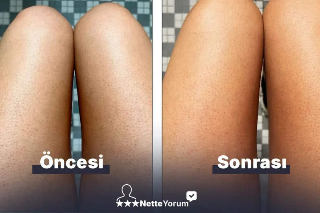 Görsel - Kullanıcı Yorumları