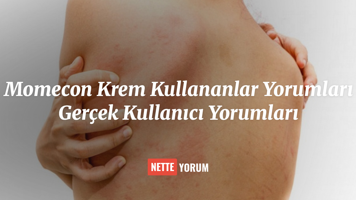 Momecon Krem Kullananlar Yorumları - Gerçek Kullanıcı Yorumları