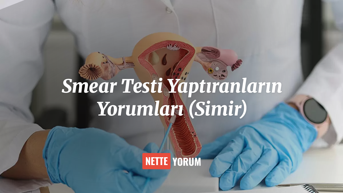 Smear Testi Yaptıranların Yorumları (Simir)