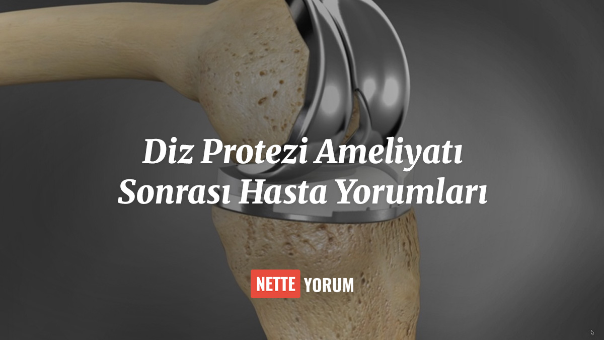 Diz Protezi Ameliyatı Sonrası Hasta Yorumları